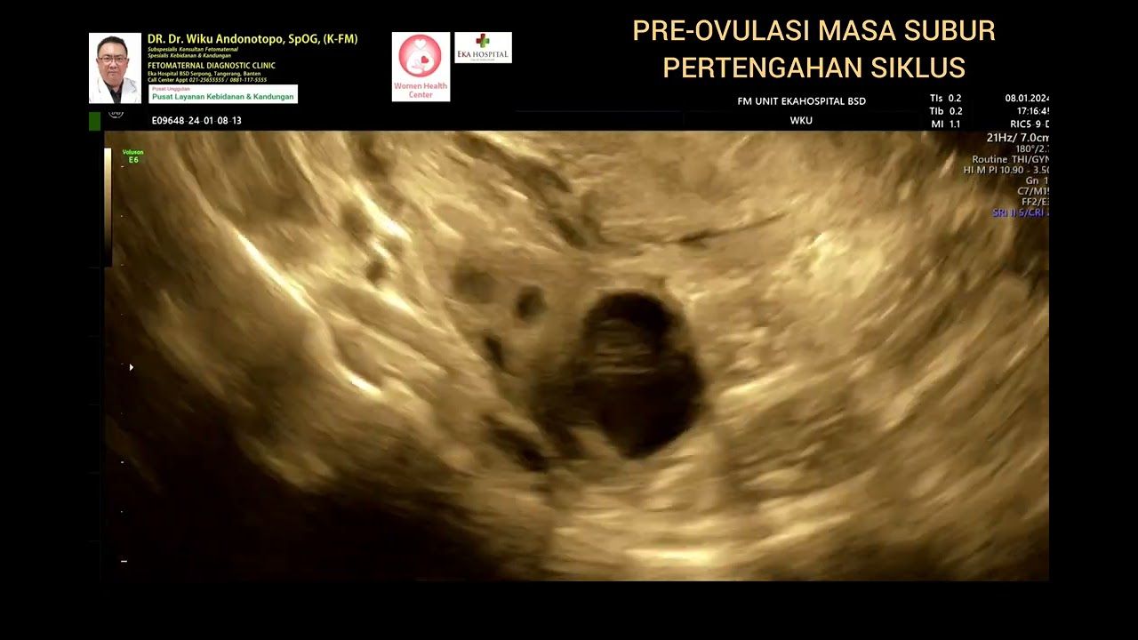 Pre ovulasi masa subur