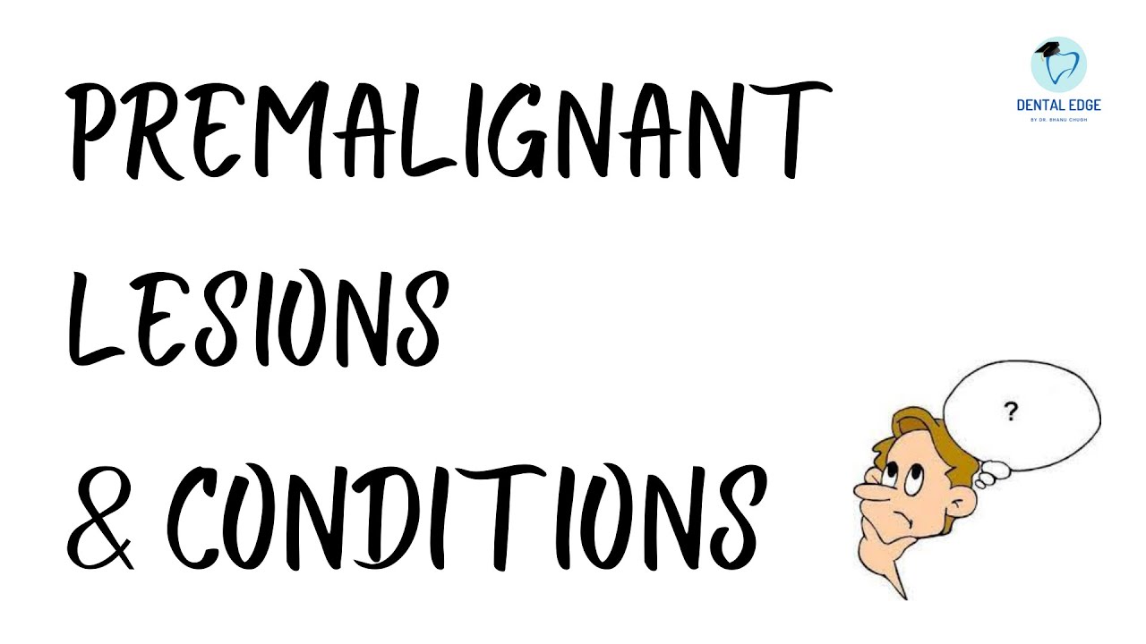 PREMALIGNANT LESIONS & CONDITIONS I BENIGN & MALIGNANT TUMORS OF ORAL CAVITY I ORAL PATHOLOGY
