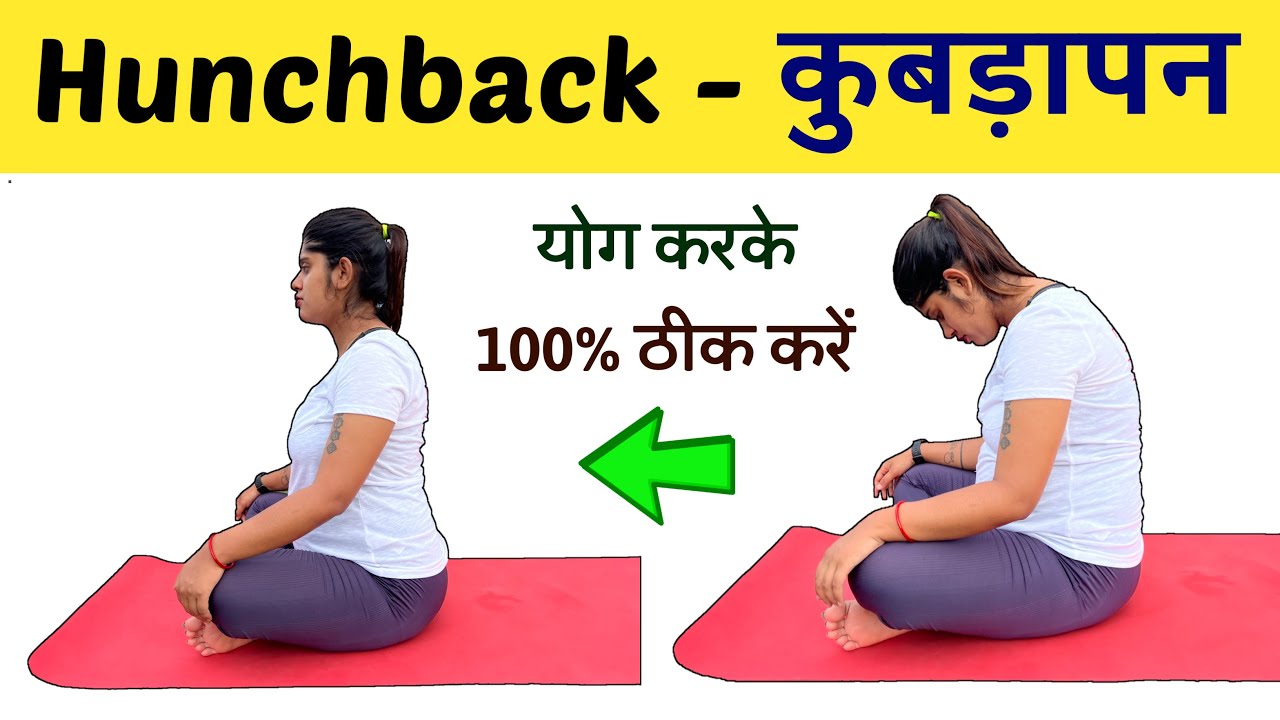 कूबड़ अंदर करने के लिए रामबाण योगासन | Yoga Exercise for Hunchback Problem | Yogawale