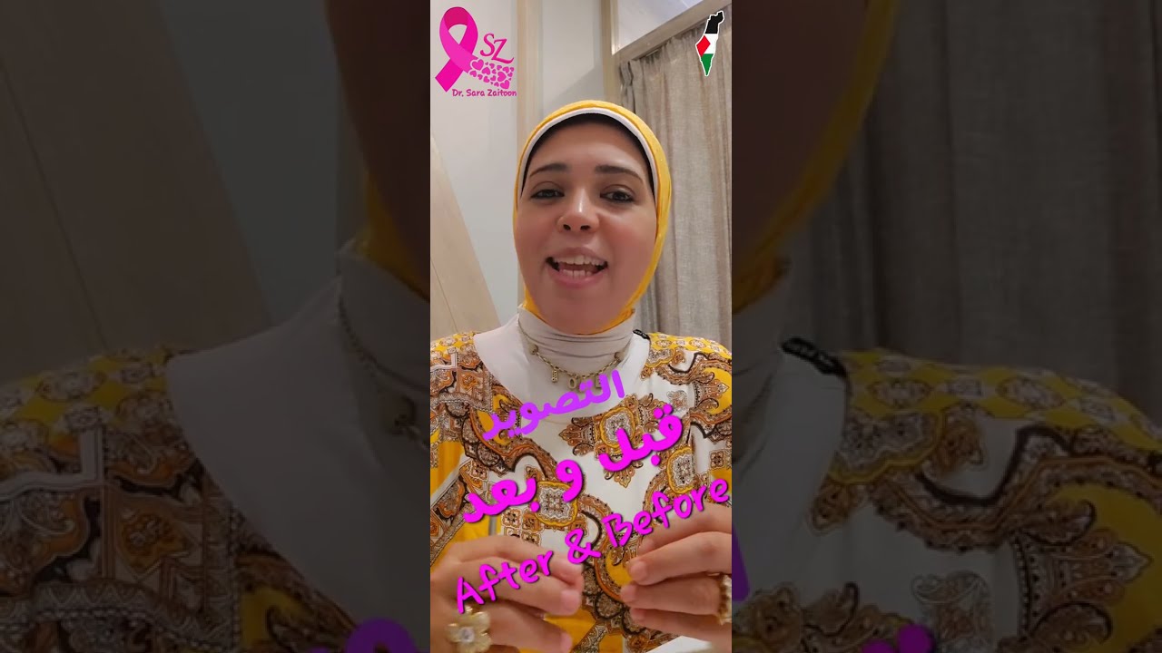 تصوير حالات التجميل قبل وبعد After&Before مع د.سارة زيتون
