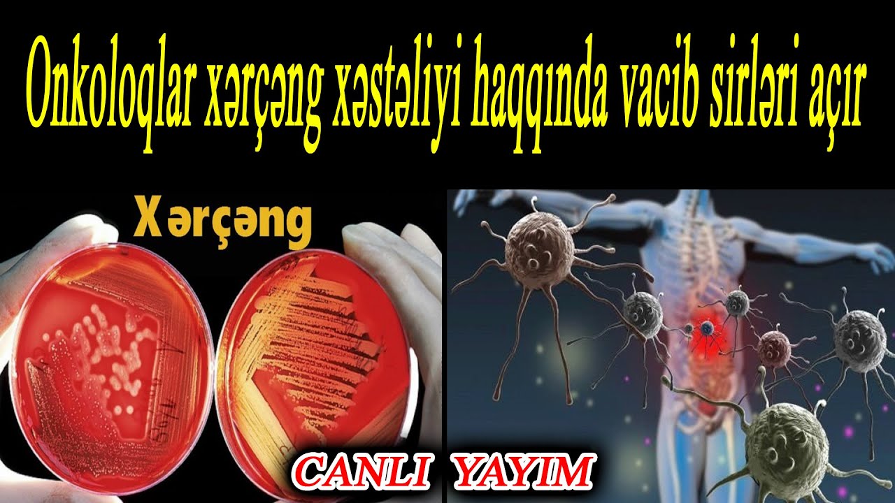 Onkoloqlar xərçəng xəstəliyi haqqında vacib sirləri açır