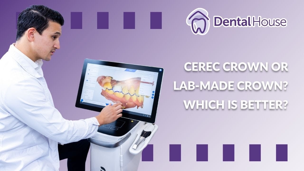 CEREC Crown or Lab-Made Crown? Which Is Better?