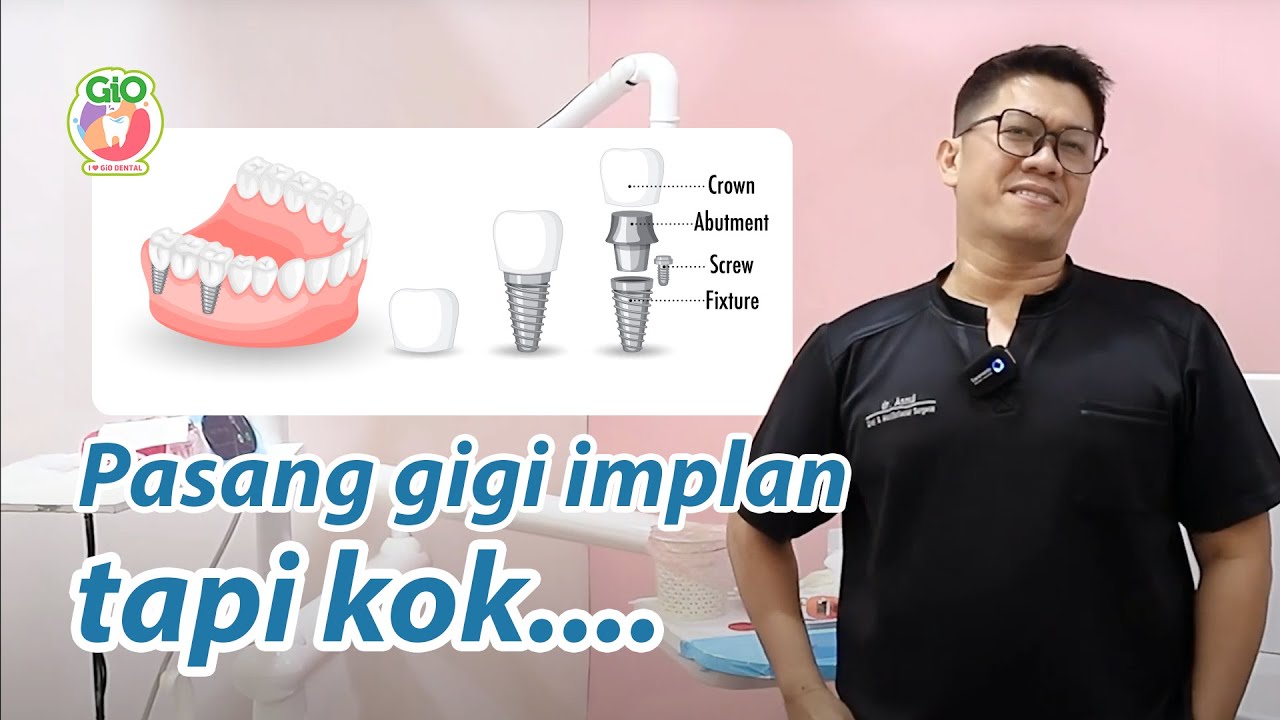 Memangnya gigi implan bisa menguning atau rusak ya?