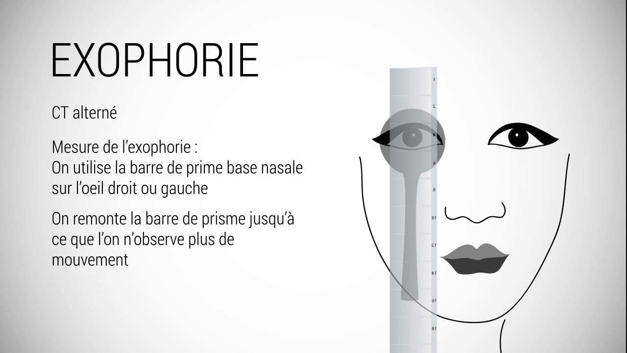 HETEROPHORIES