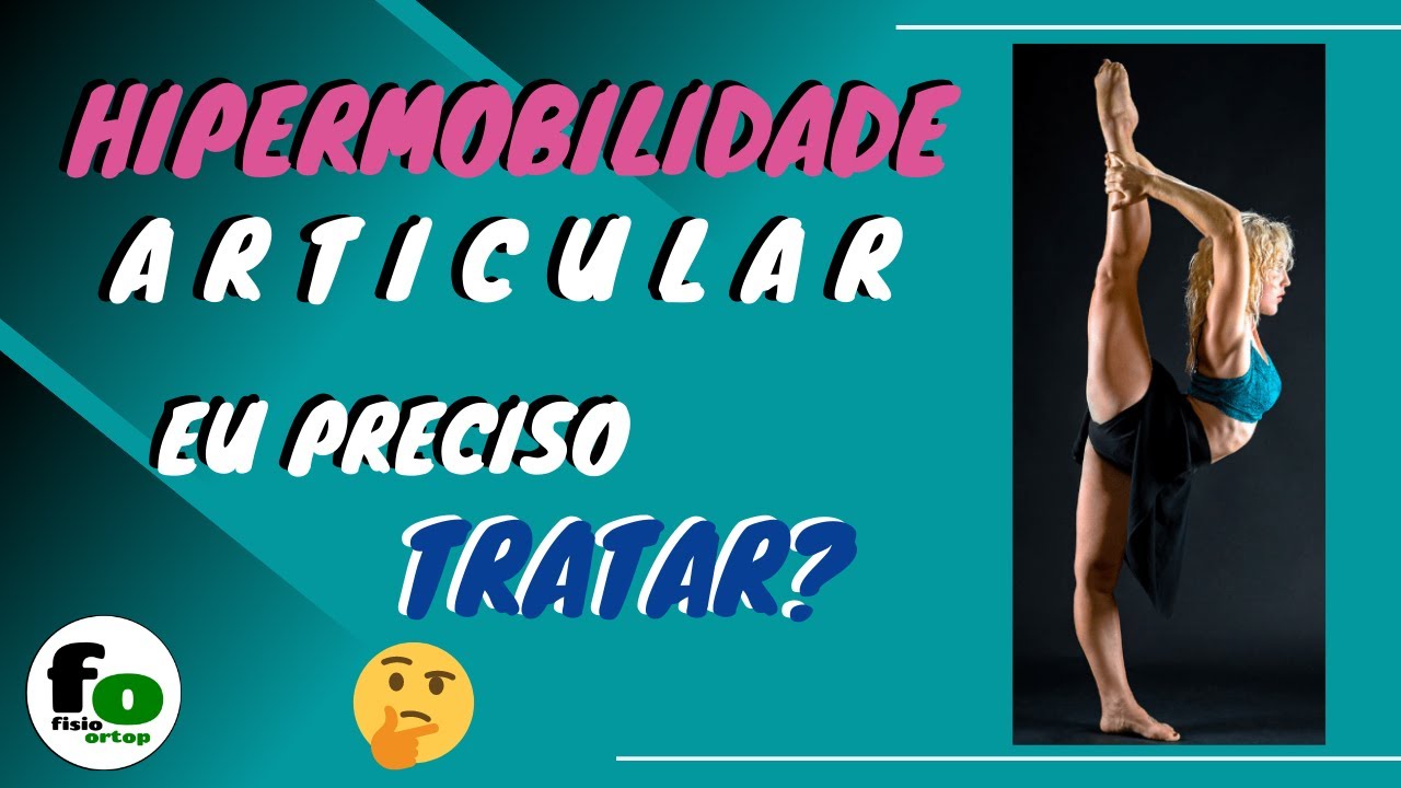 Hipermobilidade articular: eu preciso tratar?