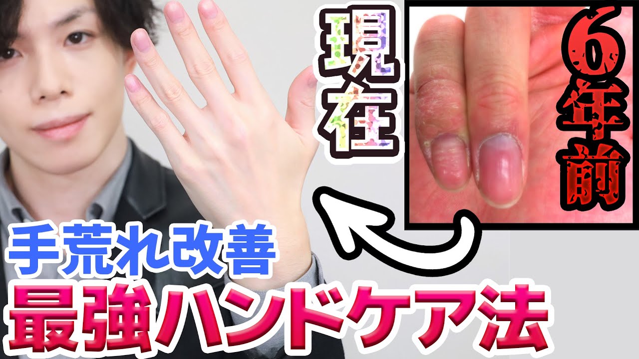 僕のボロボロ手荒れを改善した【最強ハンドケア法】　市販ハンドクリームで手荒れが治まらない人、簡単ひと手間『Wハンドケア』試してみて！