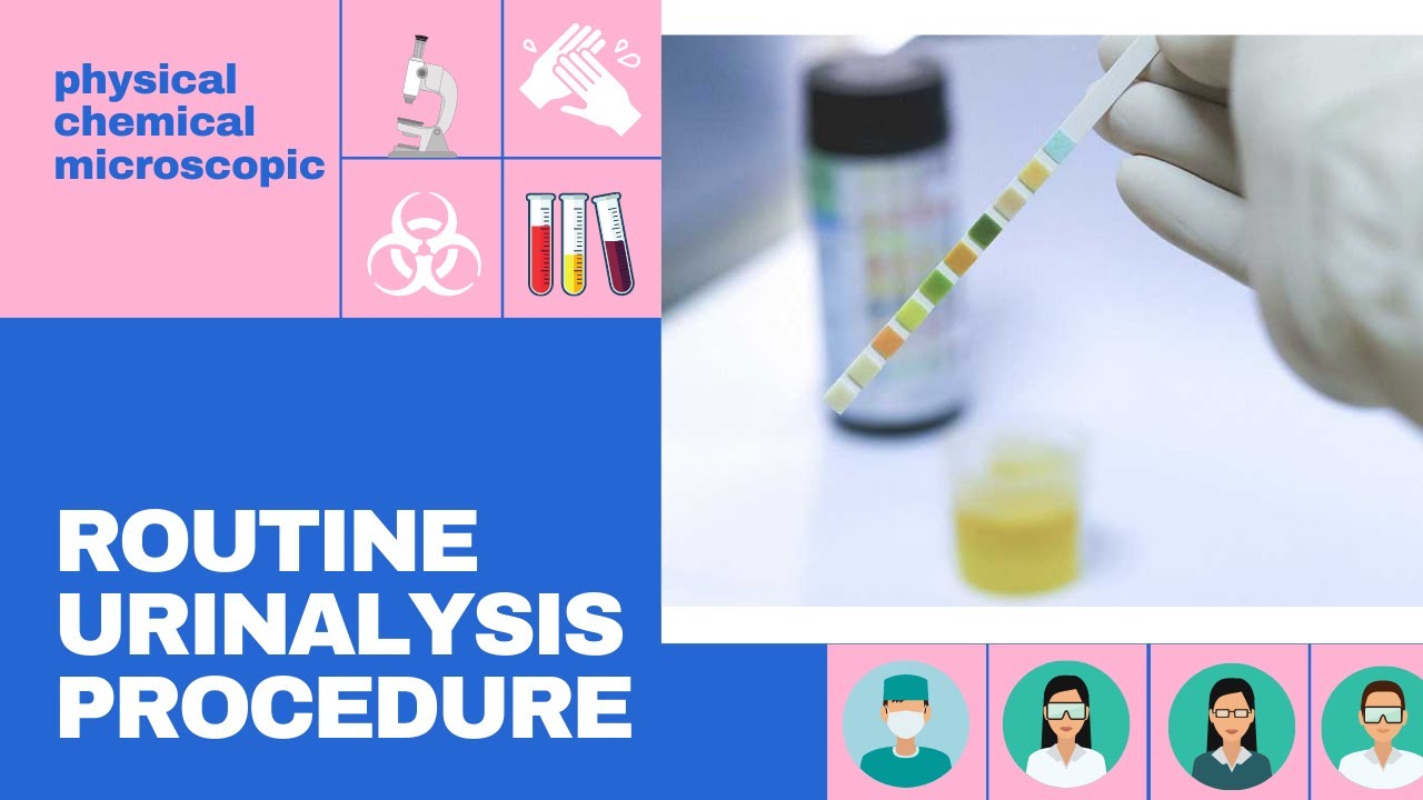 AUBF - Routine Urinalysis Procedure
