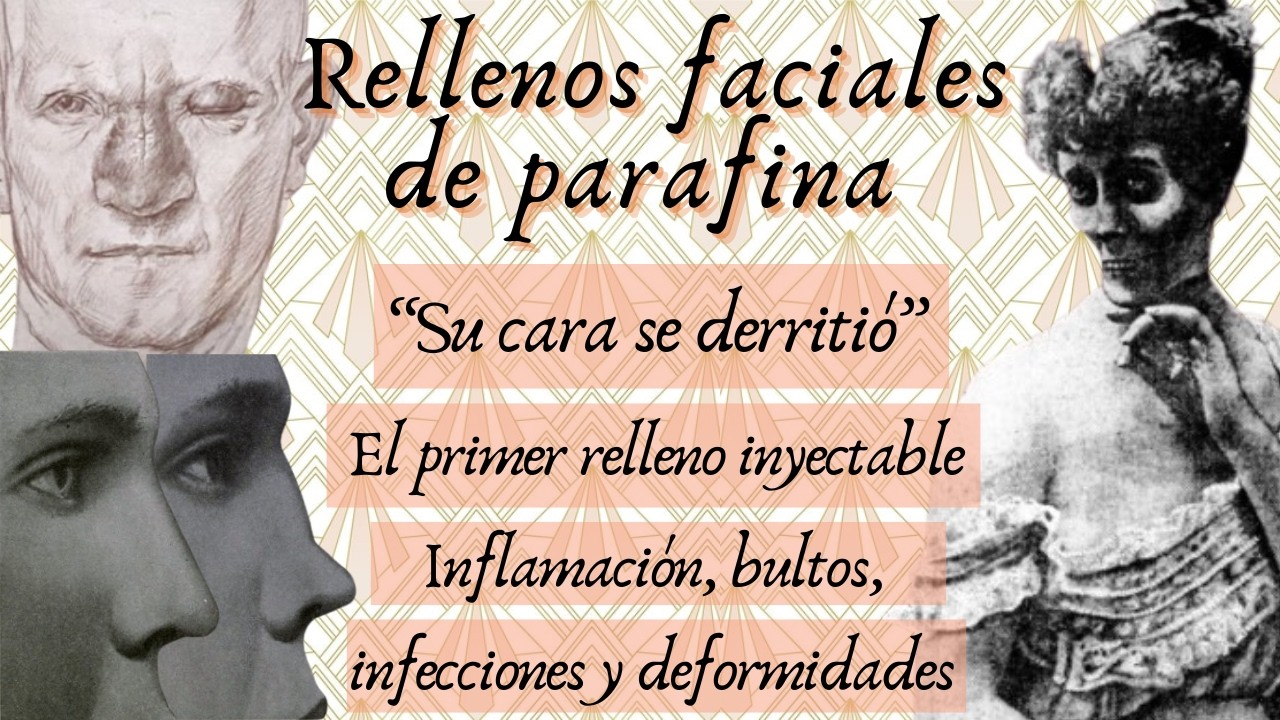 Relleno facial de parafina s. XX: 