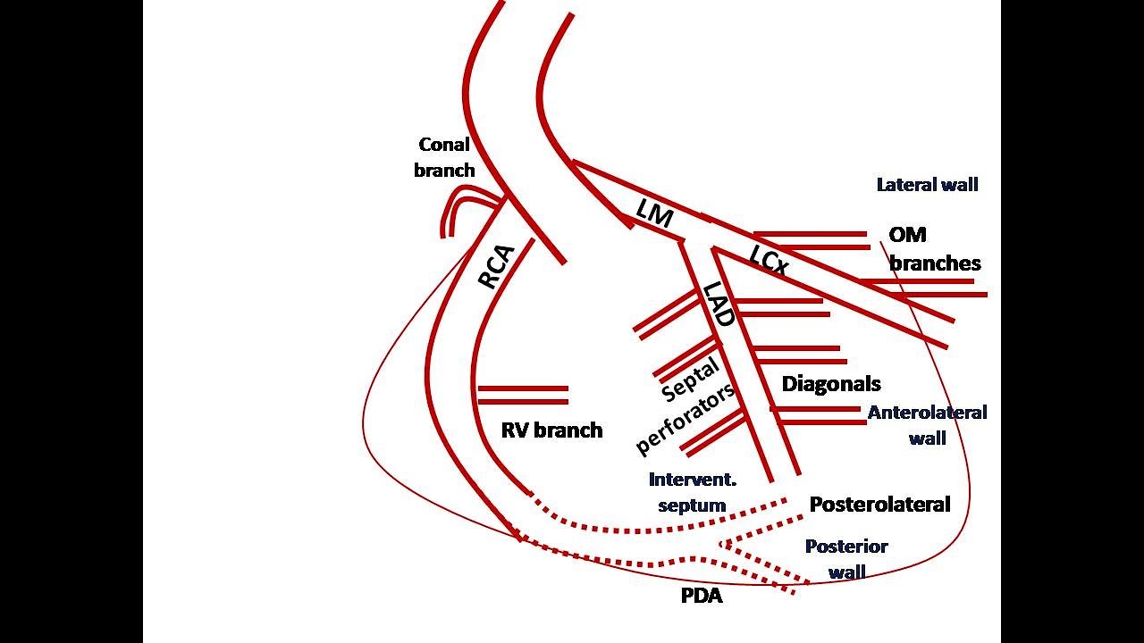 ECG course: Localization of Myocardial Ischemia, Dr. Sherif Altoukhy