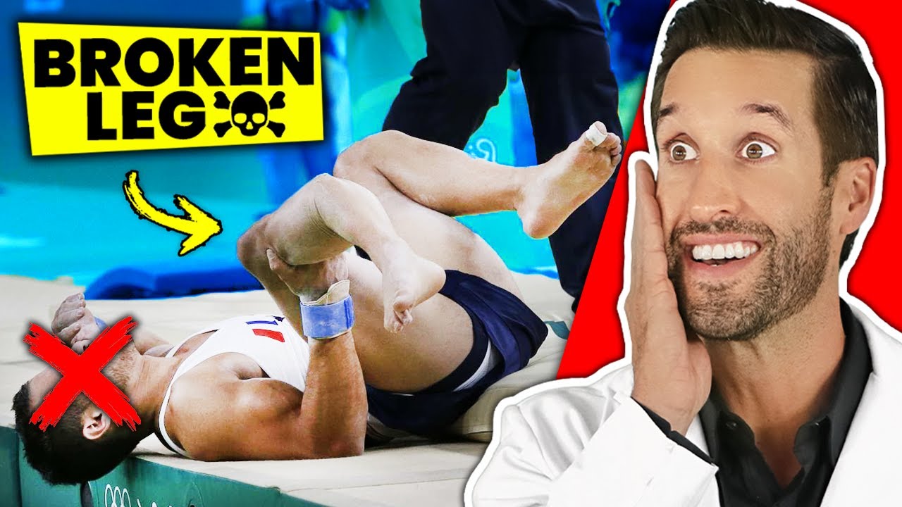 5 САМЫХ БОЛЕЗНЕННЫХ переломов костей которые вы КОГДА-ЛИБО испытывали!