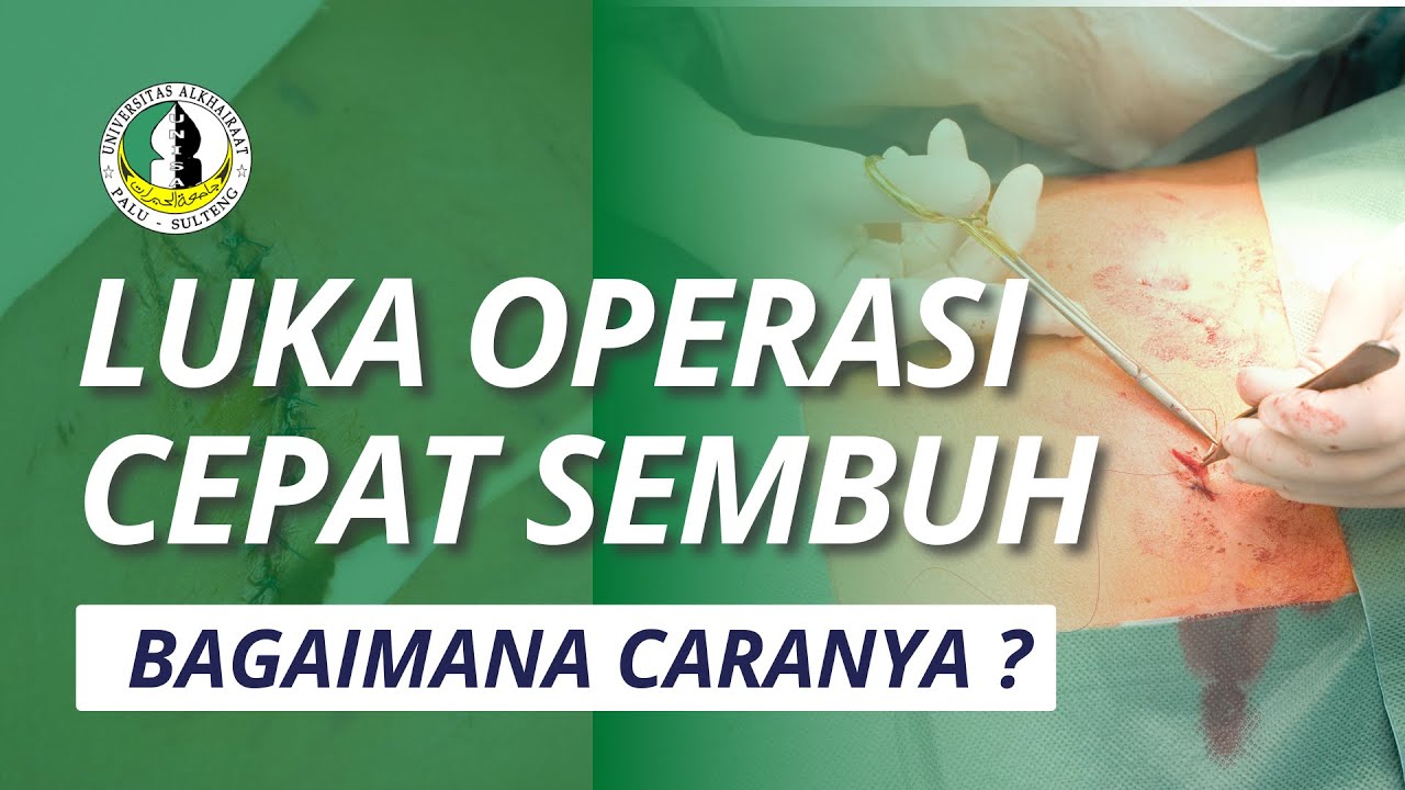 Luka Operasi atau Luka Jahitan Cepat Sembuh | Tips Dokter agar Luka Cepat Kering dan Tidak Infeksi