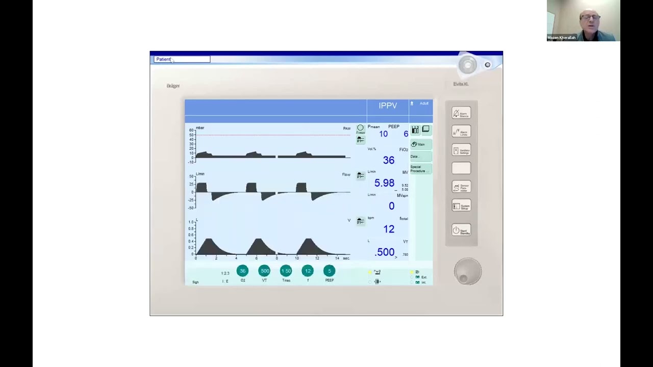 Demystifying the Equation of Motion in Mechanical Ventilation