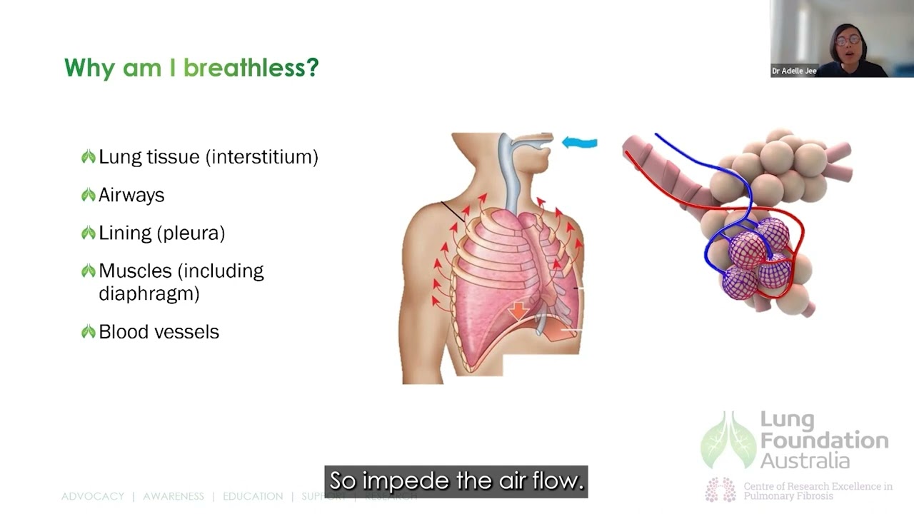 An introduction to Connective Tissue Disease-associated Interstitial Lung Disease (CTD-ILD) webinar