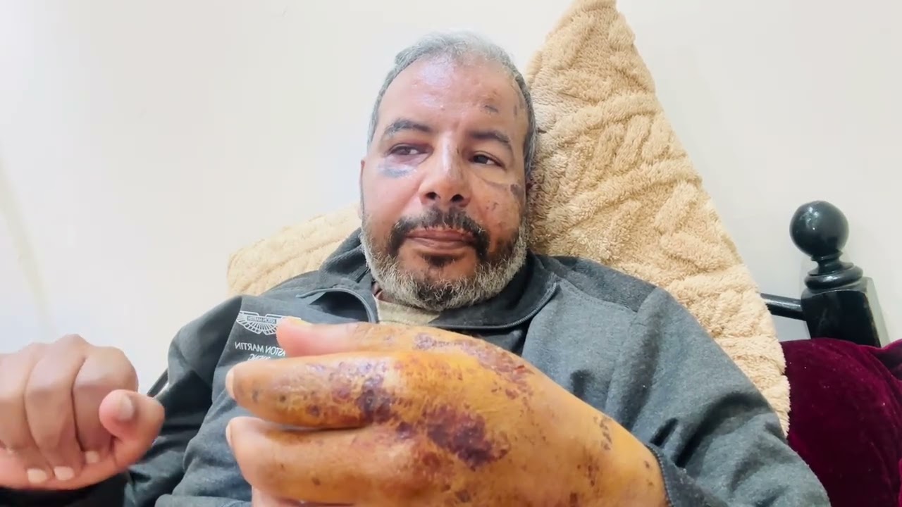 أول ظهور بعد الحااادثة @morroco2027 