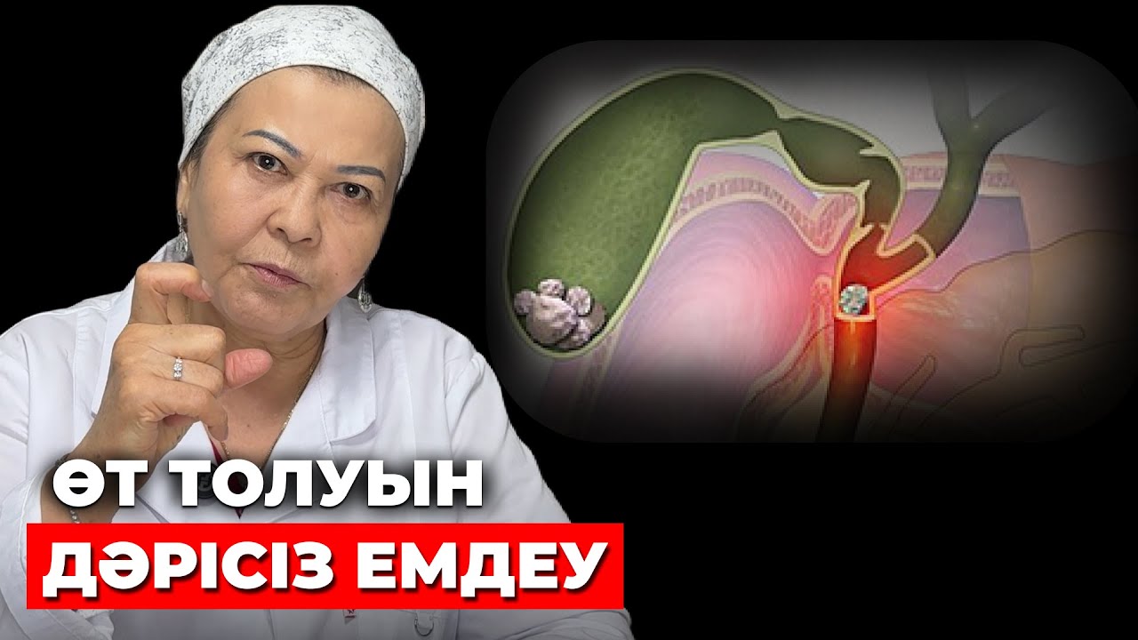 Өт тазалау жолдары: 31 жылдық дәрігерден | Өт толғанда не істеу керек?