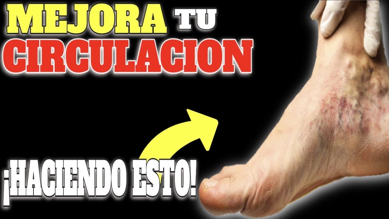 ¡RÁPIDO y FÁCIL! 3 TRUCOS para COMBATIR la MALA CIRCULACIÓN en PIERNAS - VARICES e HINCHAZÓN