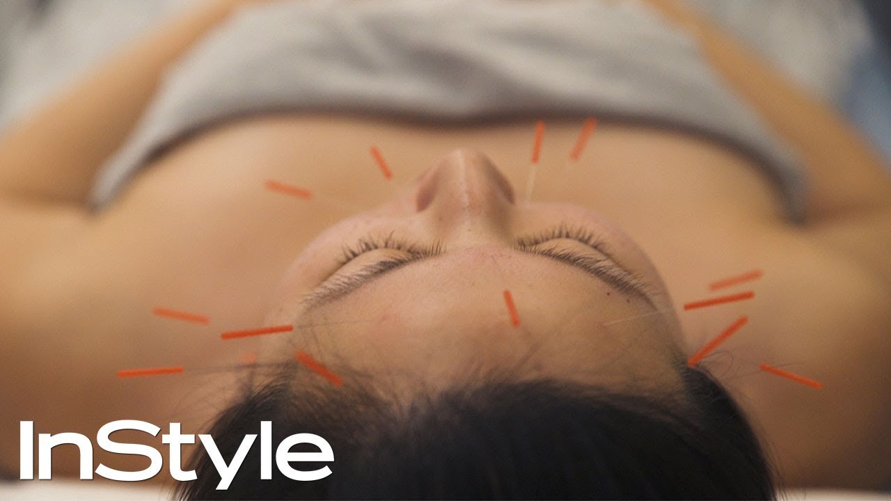We Tried Anti-aging Facial Acupuncture | Beauty Now | InStyle