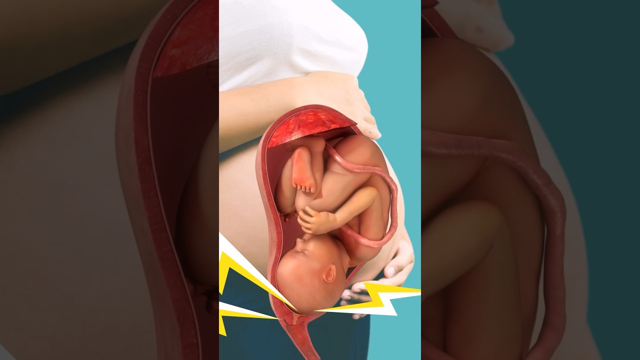 Lightning Crotch ⚡️⚡️⚡️ #pregnancy