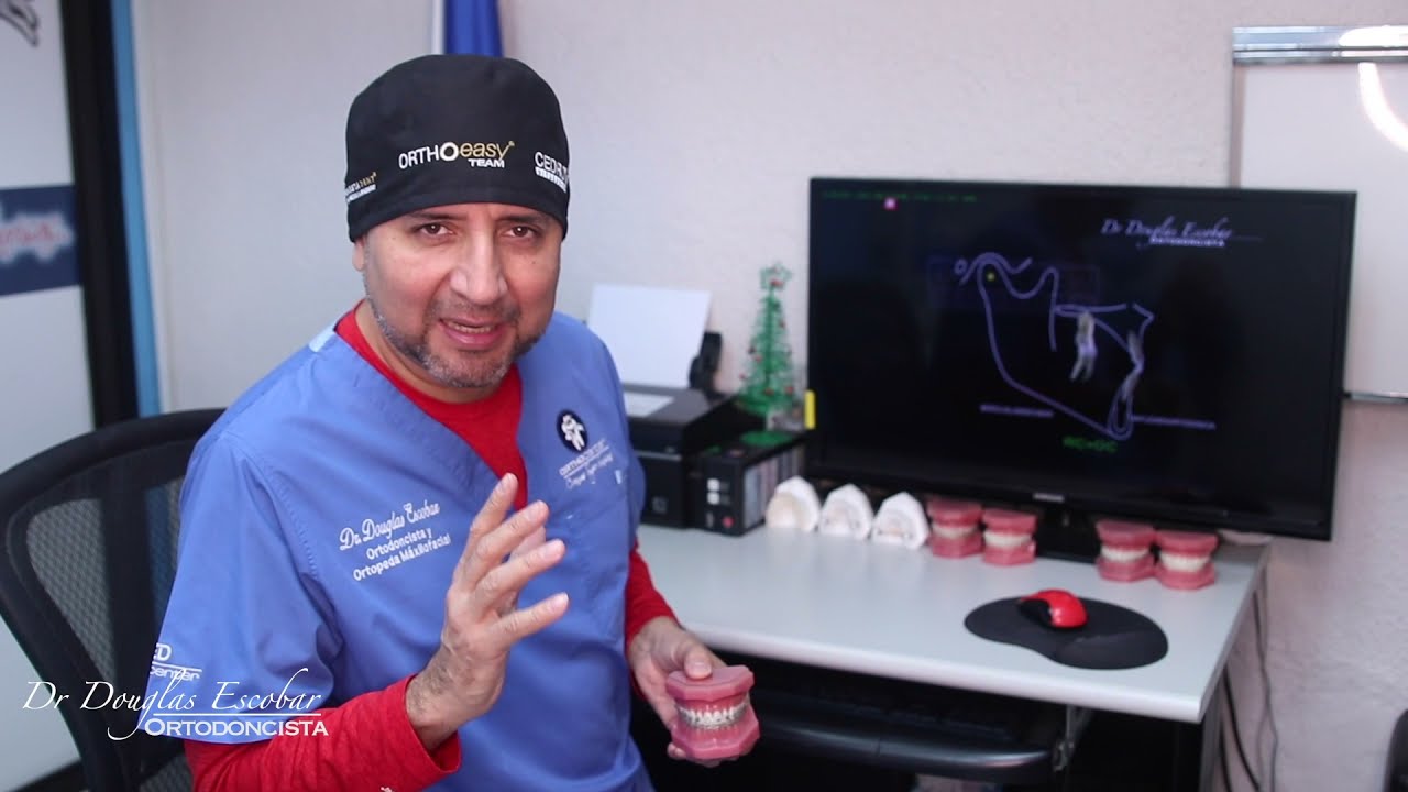 Importancia de la guía anterior en el movimiento masticatorio - Dr. Douglas Escobar Ortodoncista.