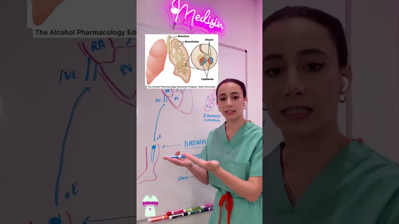 Deep Vein Thrombosis and Pulmonary Embolism - Pathophysiology, Signs, Symptoms