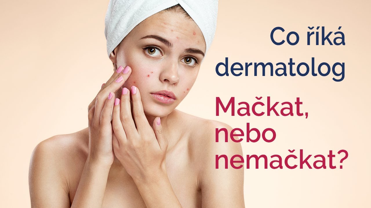 Mačkat, nebo nemačkat? Co říká dermatolog