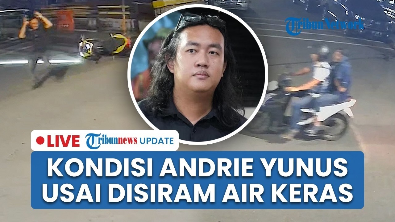 Kondisi Aktivis Kontras Andrie Yunus usai Disiram Air Keras, Prabowo Didesak usut Otak Pelaku