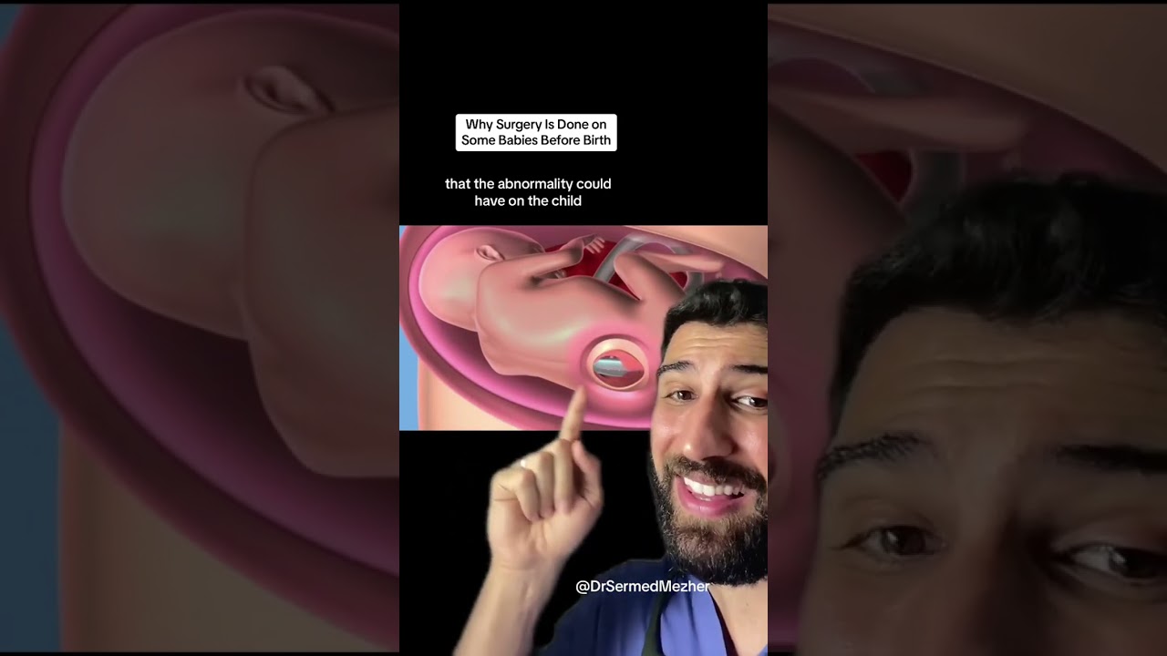 This is Why Some Babies Need Surgery Before Being Born 