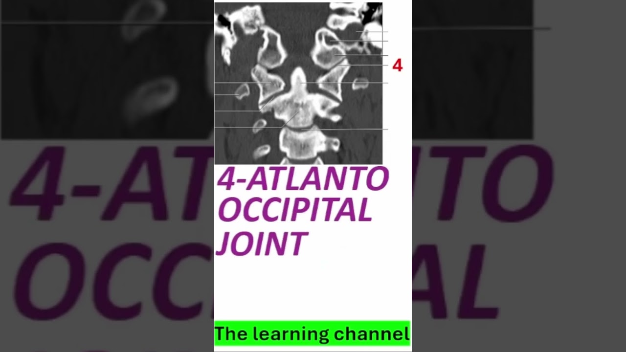 #radiology #radiologyresident #radiologiadigital #anatomy #doctor #neetpgexam #neetpgexam