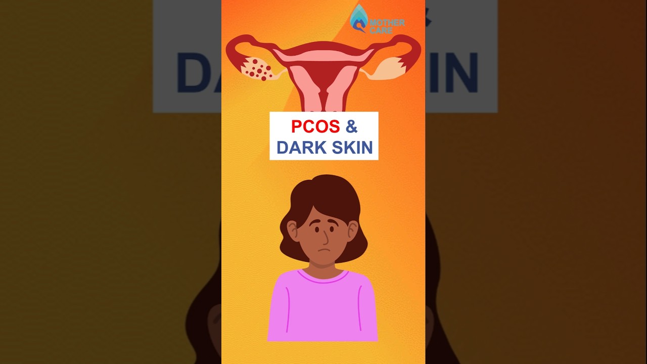 Dark Skin during PCOS | Dr Supriya Puranik #drsupriyapuranik #pcos #mothercare #ivfspecialistinpune