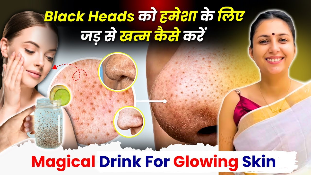 चेहरे के Blackheads, Whiteheads से पायें छुटकारा | घर पर पायें Glowing Skin | Upasana Ki Duniya