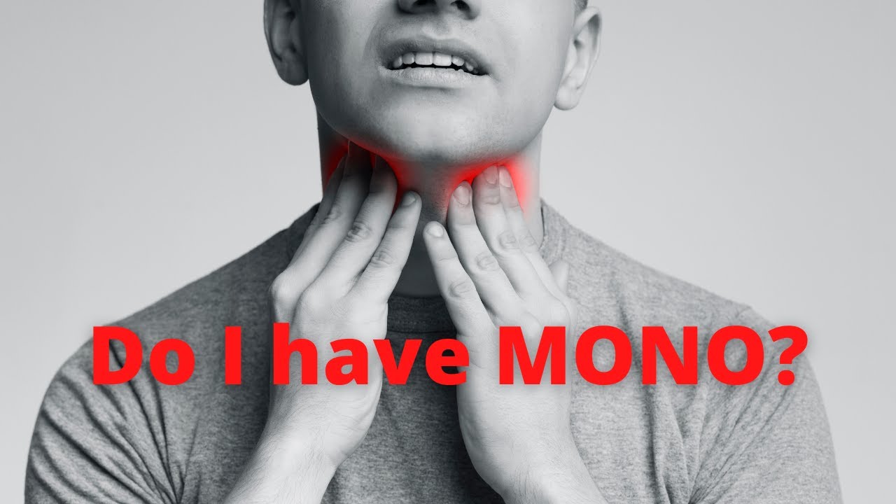 Infectious Mononucleosis:  How To Diagnose & Treat