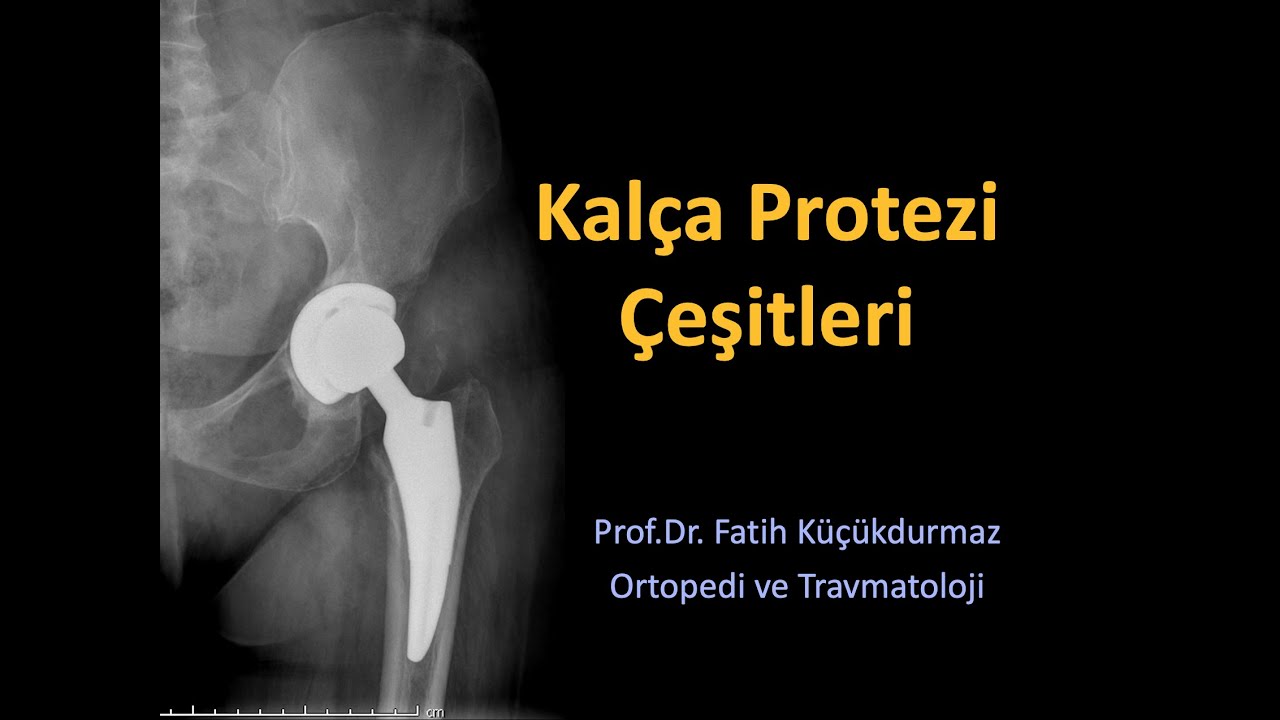 Kalça Protezi