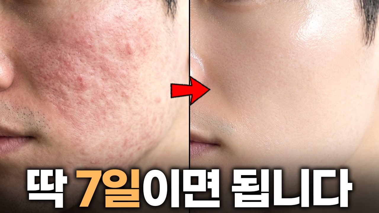 긴급처방❗피부 장벽 무너졌을 때, 가장 빠르게 회복하는 루틴 3단계