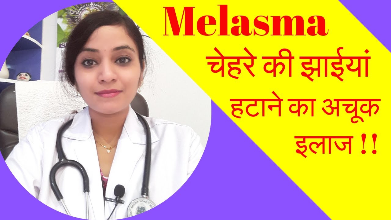 melasma treatment | melasma homeopathic treatment | hyperpigmentation homeopathic medicine | Video