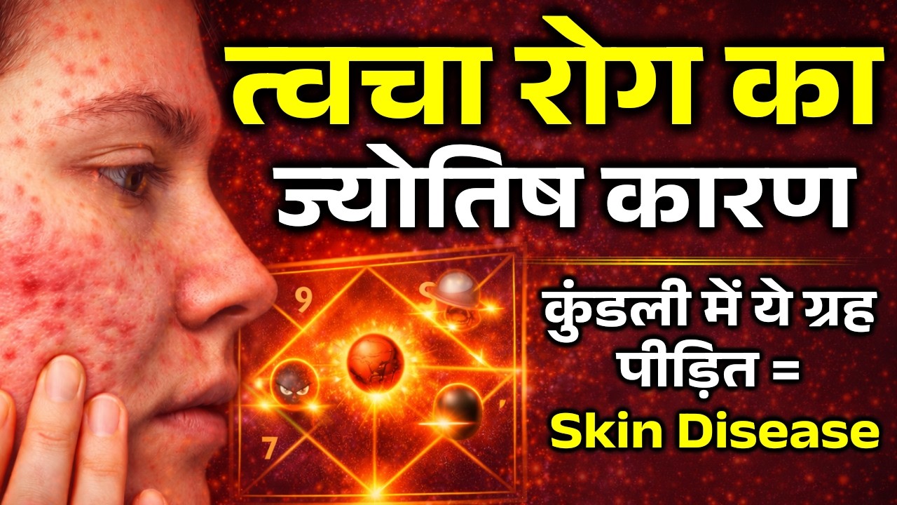 त्वचा रोग का ज्योतिष कारण | कुंडली में ये ग्रह पीड़ित हों तो Skin Disease | AstroMotive by Bharti