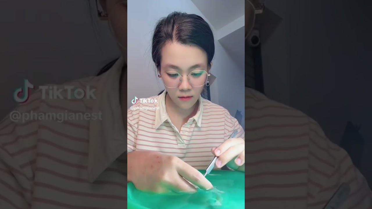 Một Ngành Đang lên rất mạnh. ( Mỗi lưng tê tay, kiêng nhẫn và tử tế) trông 5 năm tới. 