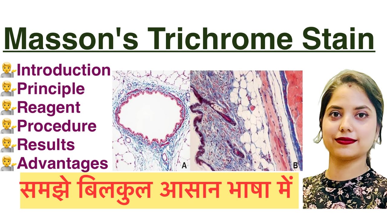 Mason’s Trichrome Stain in Hindi | Histology stain | MLT