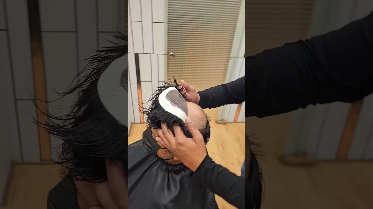 Delhi Hair Fixing | Best Hair Patch Service in Delhi #HairPatch #hairfixing