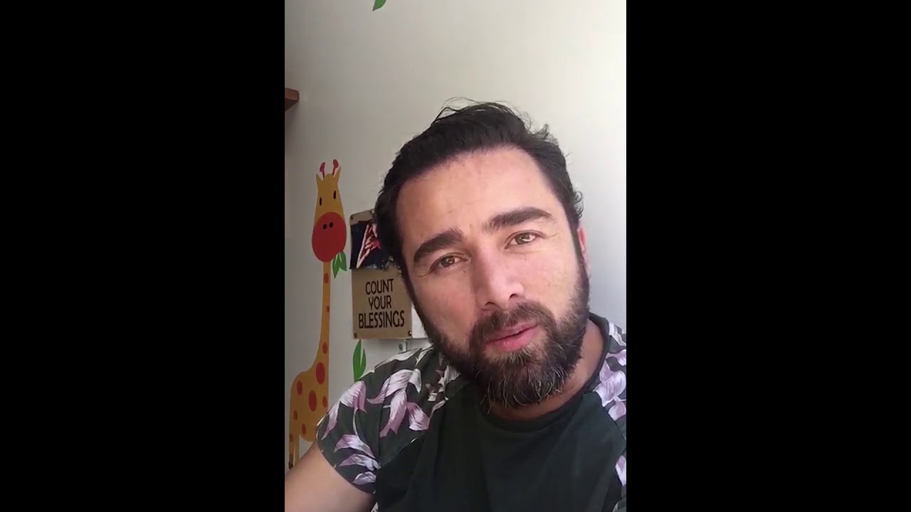 ANDRES TORO 3 AÑOS DESPUÉS DE SU PROCESO DE TRASPLANTE CAPILAR - 2RMD