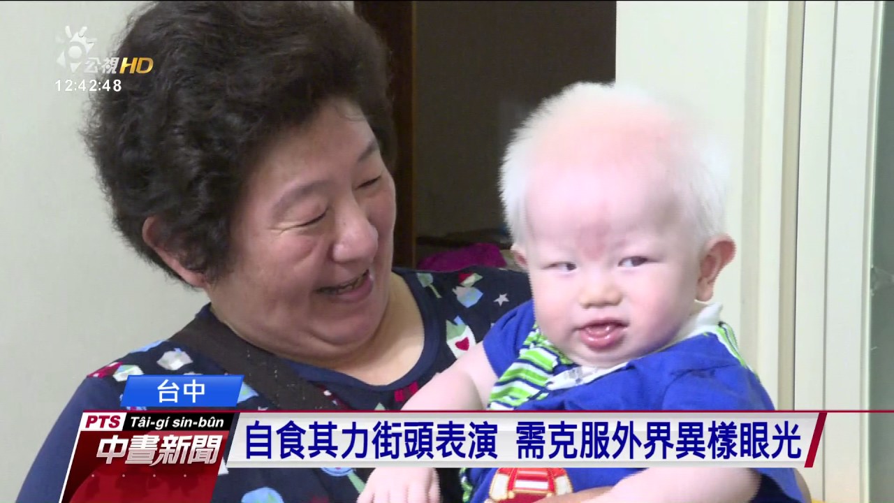 全台首個白化症家庭 白化症夫妻生兩子 2017 0519 公視中晝新聞