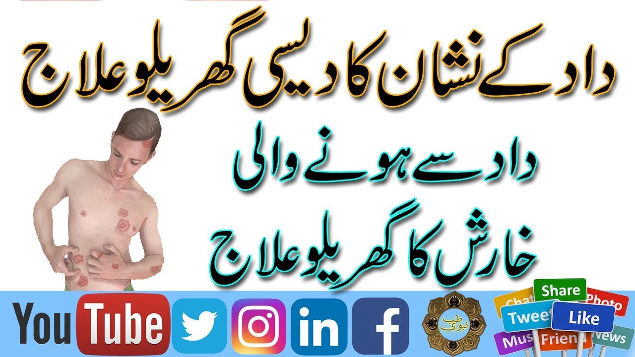 Treatment of Ringworm in Urdu | Dad se Hone Wali Kharish Ka Ghrelu Ilaj | Dad ke Nishan Ka Ilaj |