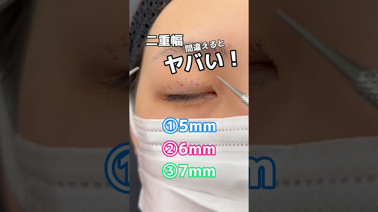 【間違えるとヤバい！！】適切な二重幅で自然で目力がある二重になれる❣️#二重整形 #二重埋没 #やなぽち#shorts