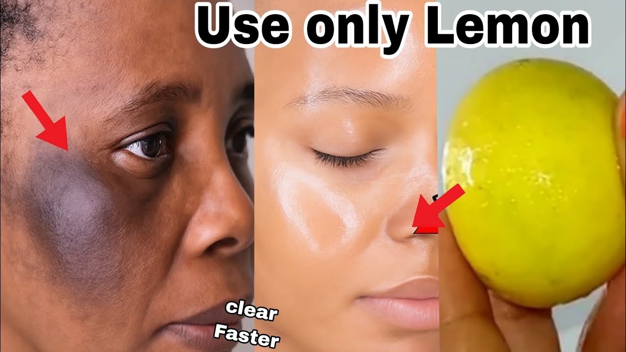 How to apply lemon on face/ apply vaseline on your skin and see the magic lemon face cleanser 🌟 
