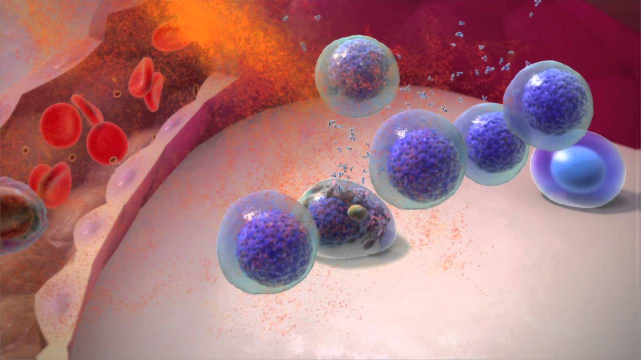 Immunotherapy in myeloma