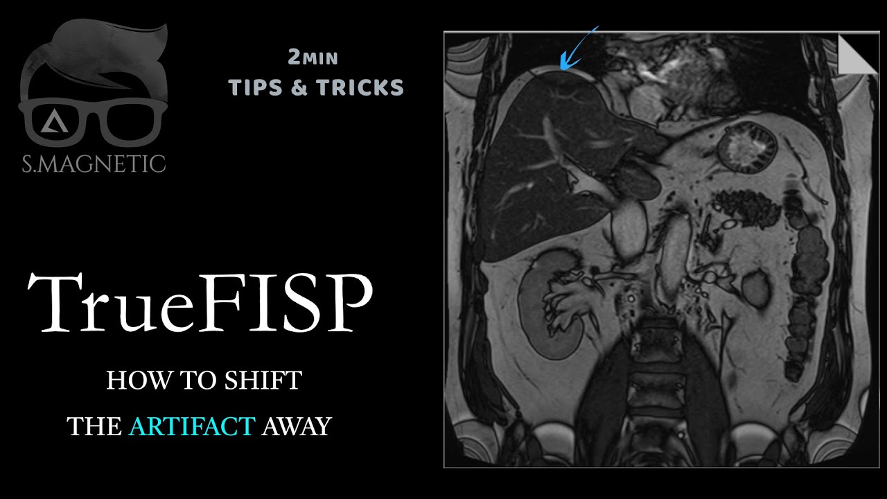 TrueFISP – HOW TO SHIFT THE ARTIFACT AWAY