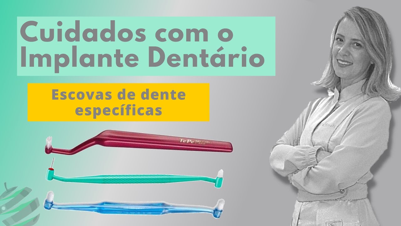 Cuidados com os Implantes Dentários - Escovas Específicas