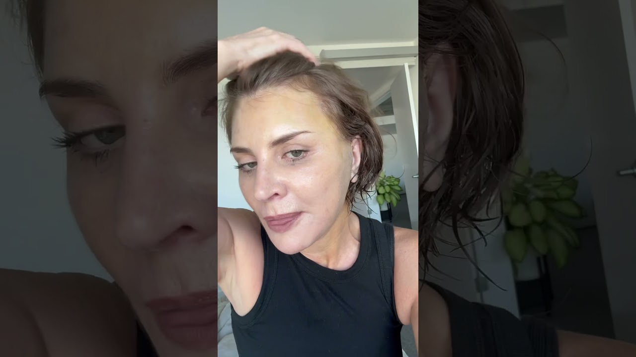 Raw feelings 9 days post facelift #recovery