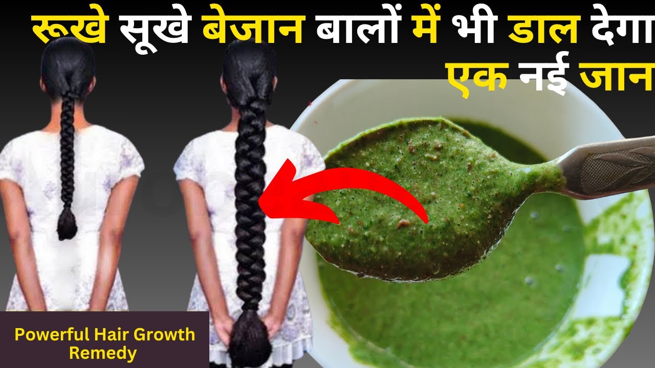 How to grow hair fast??DIY Powerful Hair Growth Remedy