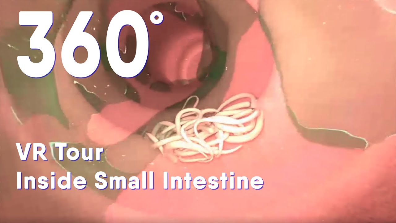 Small intestine with intestinal worms 360 VR |Intestinal Parasites |medical animation #intestin #360