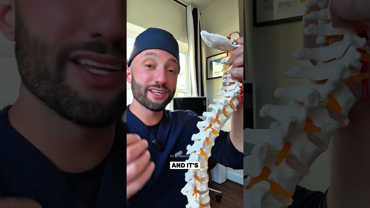 how we get a sample of CSF #lumbarpuncture #spinaltap #csf #brain #brainhealth #medical #doctor